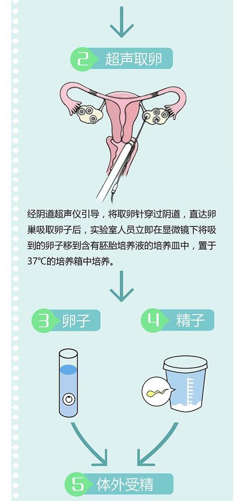 借卵试管代怀流程【借卵试管代怀流程详解】